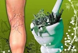 bylinky na liečbu kŕčových žíl