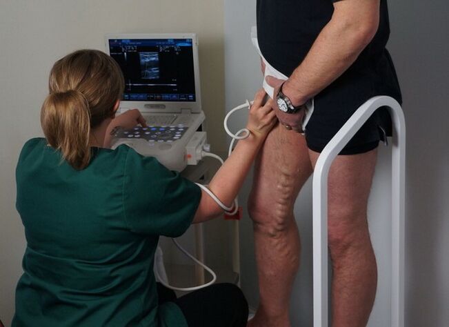 vyšetrenie žíl pred laserovou koaguláciou na kŕčové žily